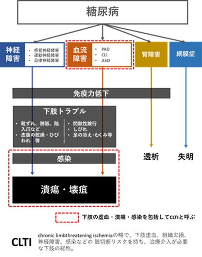 図:糖尿病の潰瘍・壊疽までの流れ