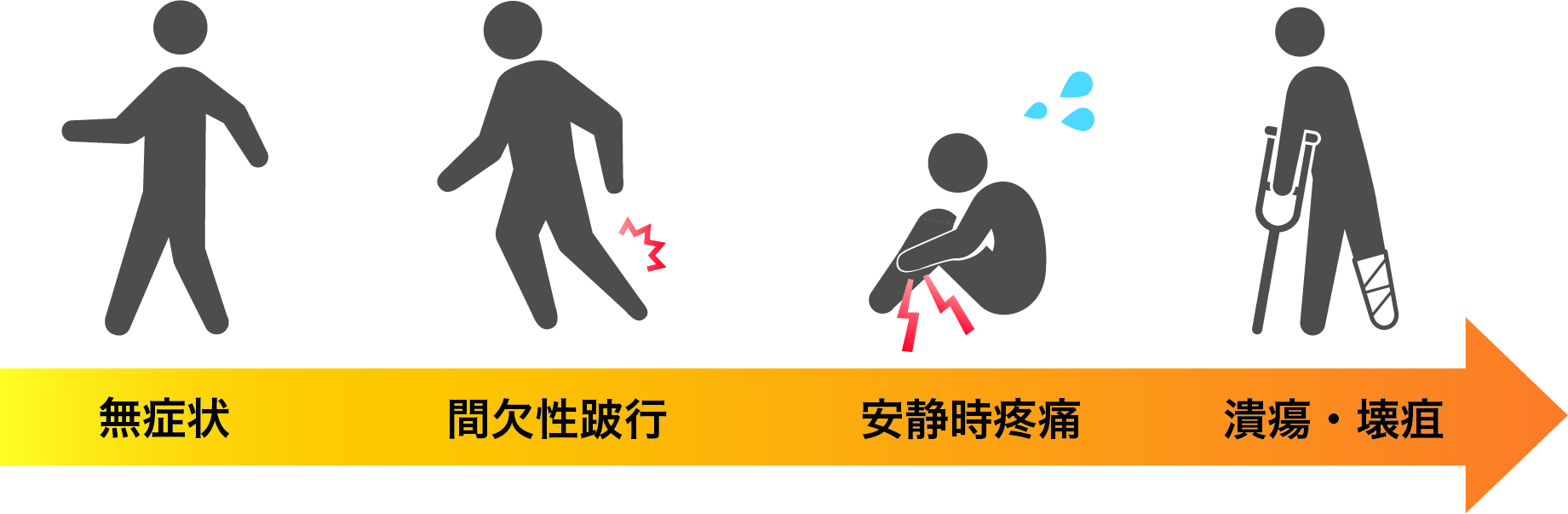 下肢閉塞性動脈疾患(LEAD:lower extremity arterial disease)